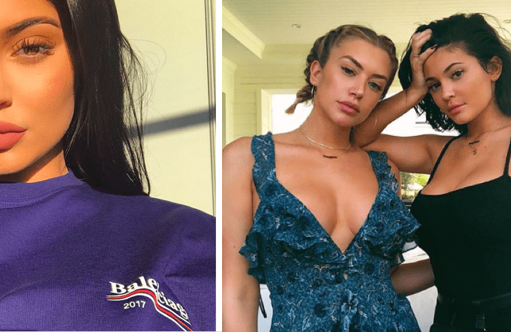 Kylie Jenner fjarlægði varafyllingarnar