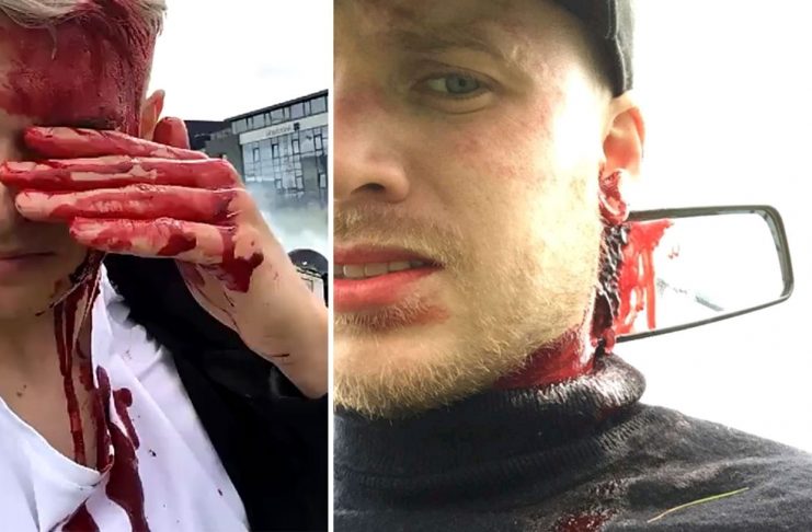 Hrollvekjandi snöpp frá Snorra Björns og Emmsjé Gauta fá hjörtu fólks til að slá örar