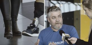 Gummi stýrir gervifætinum með huganum