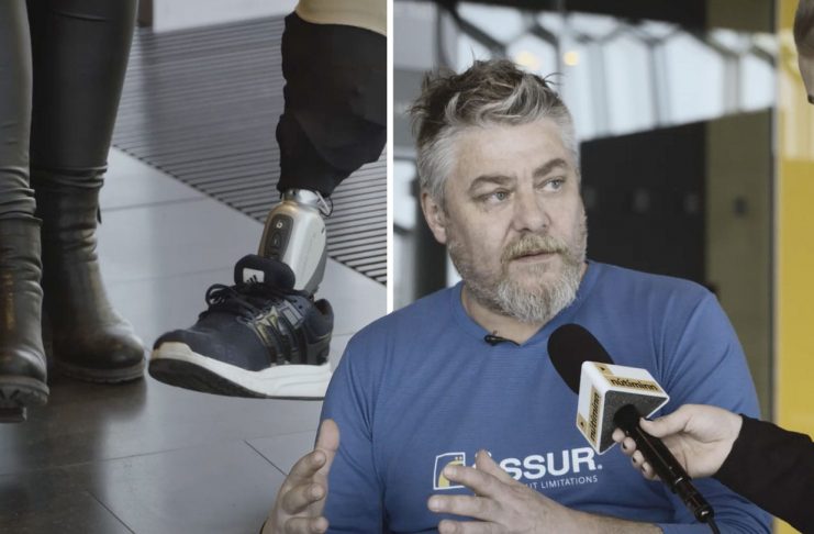 Gummi stýrir gervifætinum með huganum