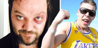 Bam Margera áfram í vandræðum: „Rapparar á Íslandi og leigubílstjóri í Kólumbíu”
