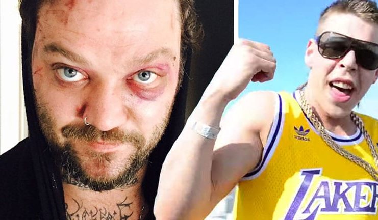 Bam Margera áfram í vandræðum: „Rapparar á Íslandi og leigubílstjóri í Kólumbíu”