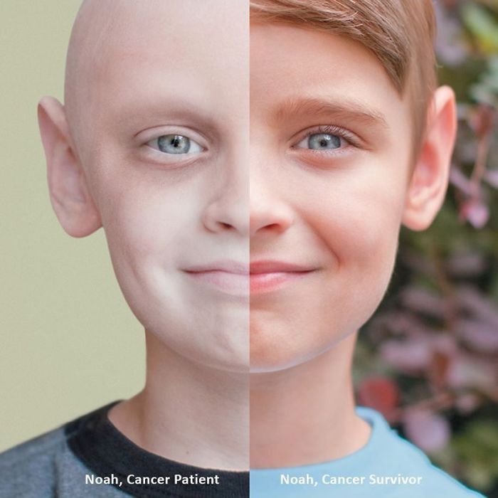 Then And Now: Cancer Patient vs. Cancer Survivor