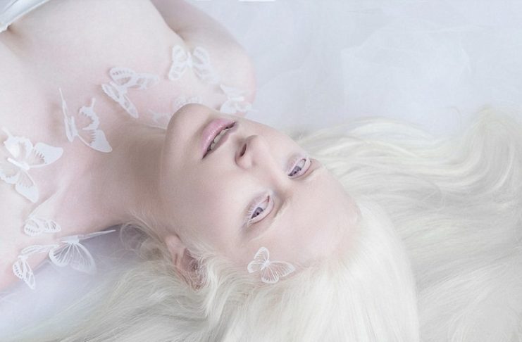 Tók myndir af albínóum til að fanga ÓTRÚLEG litbrigði þeirra!