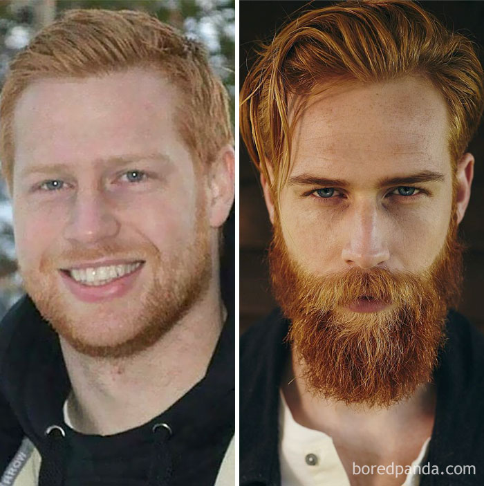 Before And After Beard