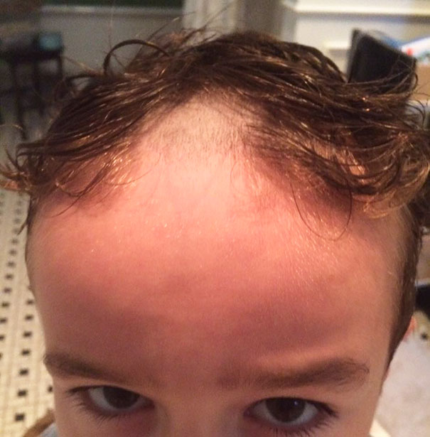 Before Bedtime One Night, After He Turned Off His Electric Tooth Brush, From The Other Room We Heard A Different Buzzing And Realized Too Late That Our 5yr Old Found My Husband's Beard Trimmer
